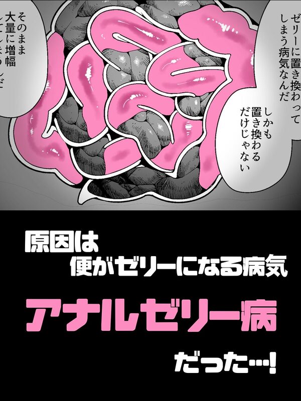 アナルゼリーという病〜人妻OLは我慢も虚しく巨尻からゼリーを吹き出す〜 画像3